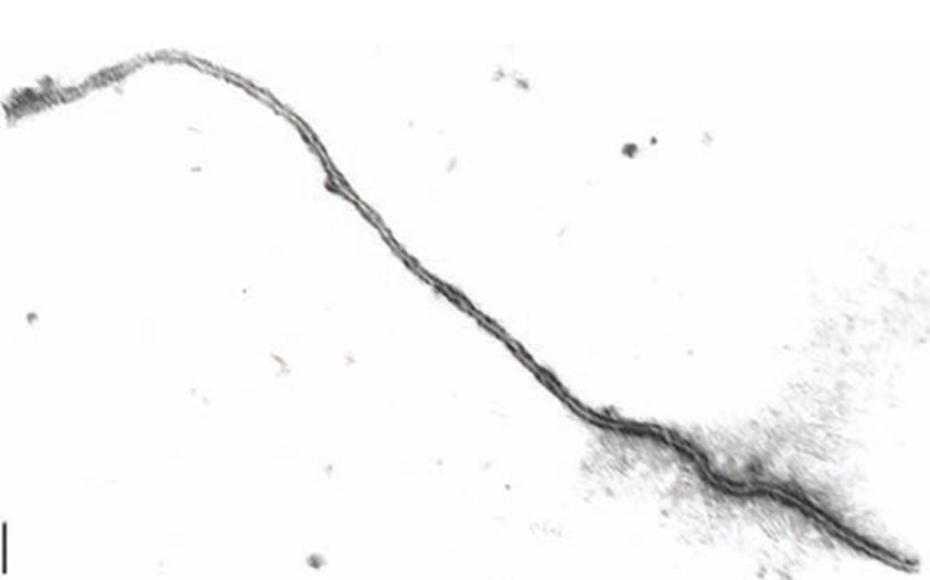 Figure 2: Electron Micrograph of Grapevine Leafroll associated Virus type 3 (1800 to 2000 nm in length and 12 nm in diameter). Reference:  "Grape Leafroll Disease" by Dr. Marc Fuchs. http://www.nysipm.cornell.edu/factsheets/grapes/diseases/grape_leafroll.pdf